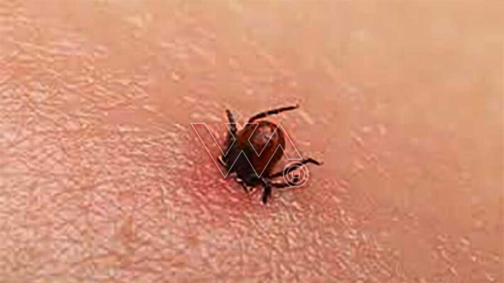 قومی ادارہ صحت نے عیدالاضحیٰ پر کانگو بخار پھیلنے سے متعلق ایڈوائزری جاری کردی